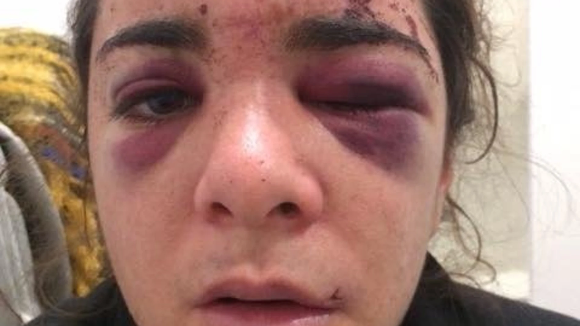 Andrea Scignano, de 27 años, publicó esta foto a través de su cuenta de Facebook