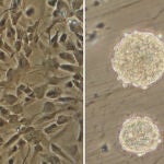 Investigadores del CONICET lograron un importante avance sobre los mecanismos de origen y crecimiento del glioblastoma, una variante de cáncer muy agresiva