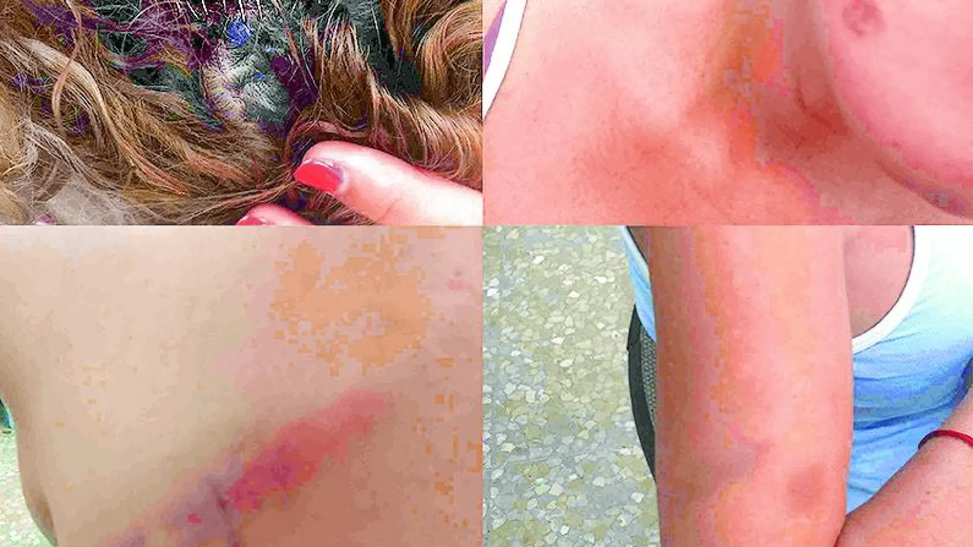 Fotografías facilitadas por el Observatorio contra la LGBTfobia, de las agresiones sufridas por una transexual en un polígono de la capital malagueña.