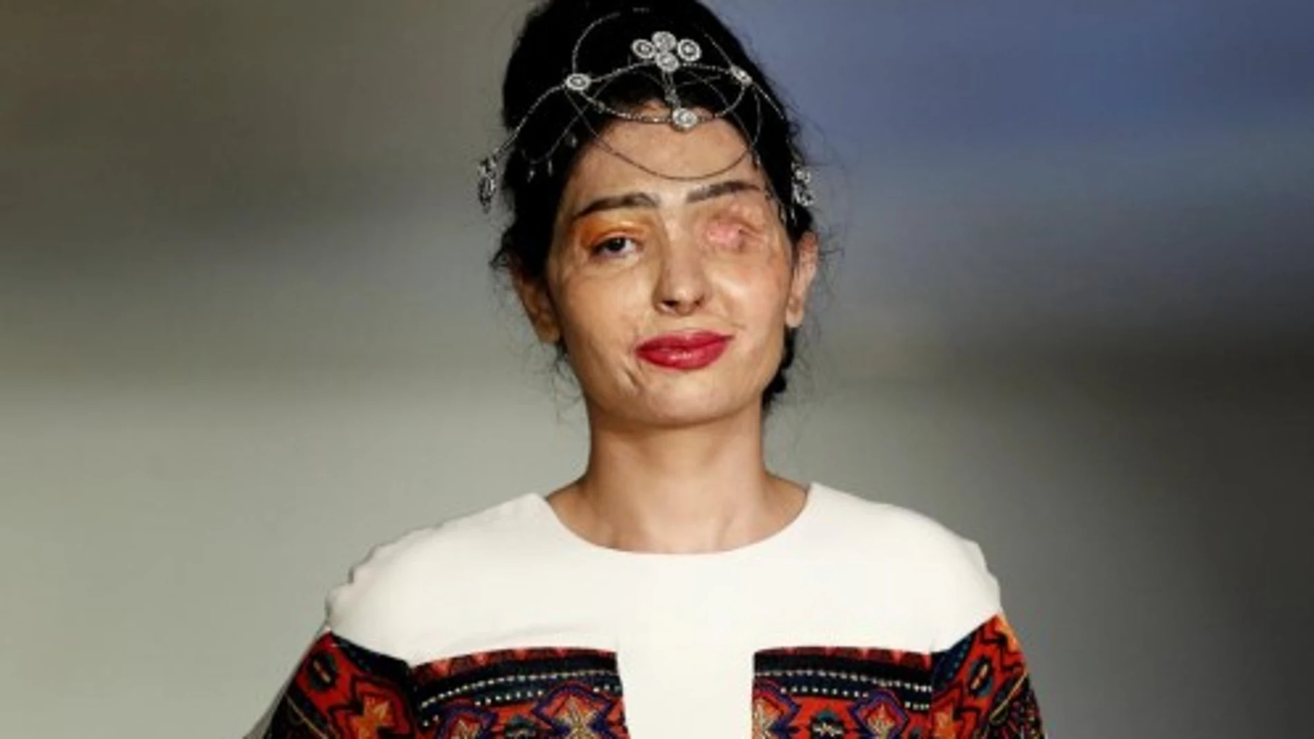 Reshma Querishi, con el rostro desfigurado por el ácido, duerante el desfile