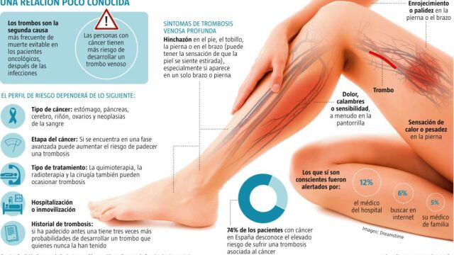 El 74% de las personas con cáncer desconoce el riesgo de trombosis