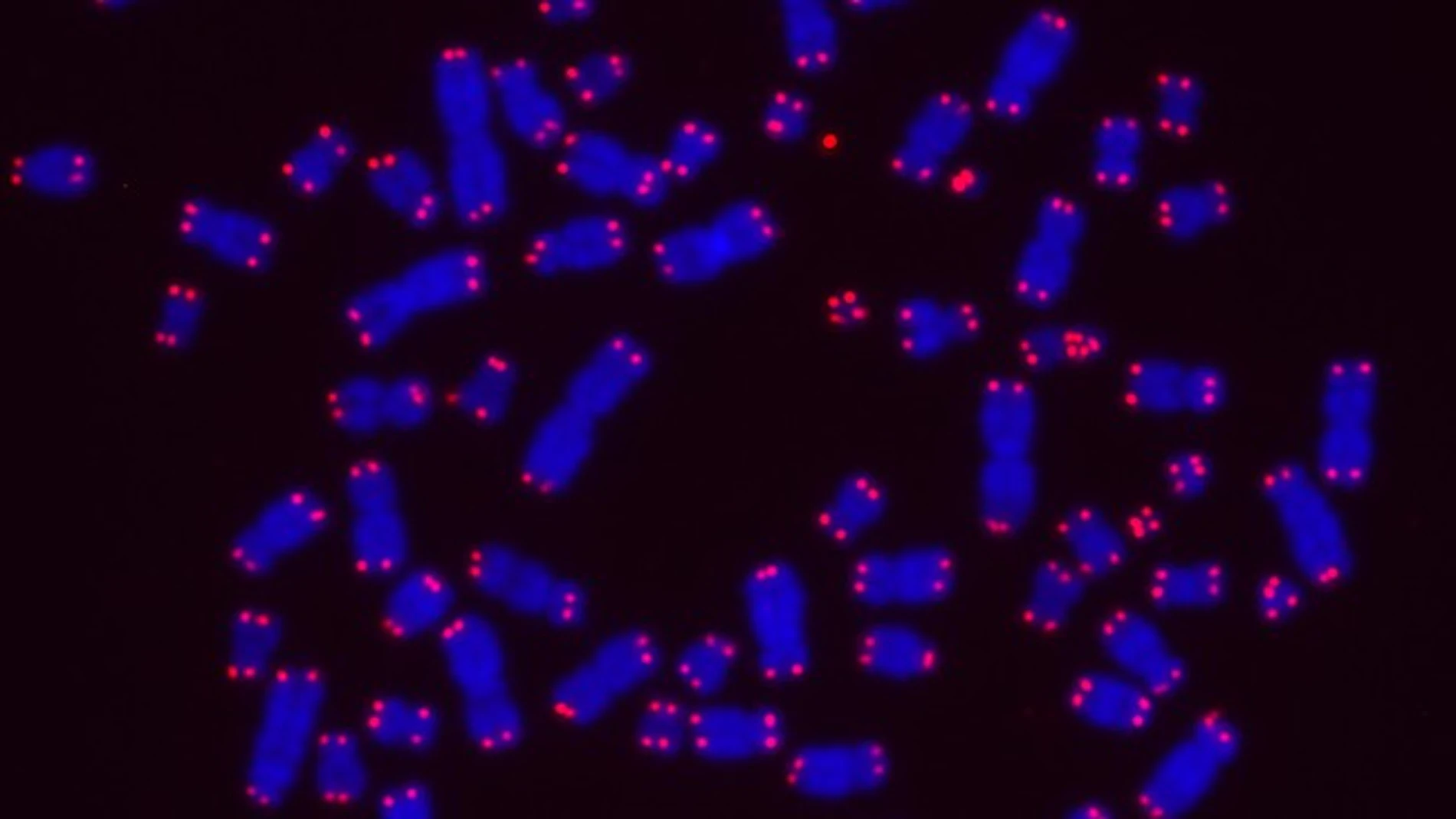 Cromosomas de células cancerígenas con sus telómeros marcados en azul/EPFL