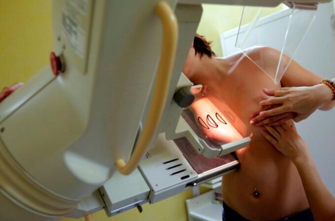 Un nuevo tratamiento alarga la supervivencia de mujeres con cáncer de ovario avanzado