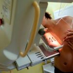 Un nuevo tratamiento alarga la supervivencia de mujeres con cáncer de ovario avanzado