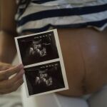 38 de los casos se han diagnosticado en embarazadas.