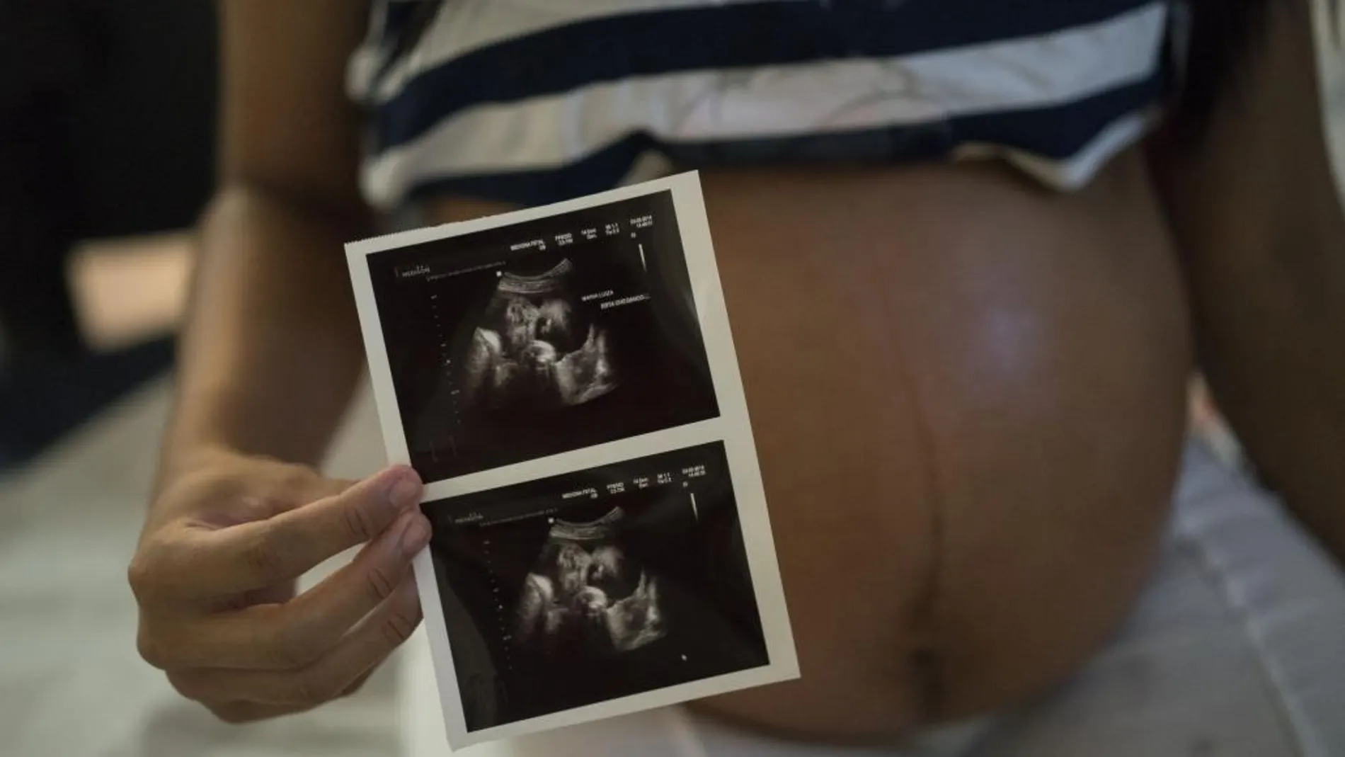 38 de los casos se han diagnosticado en embarazadas.