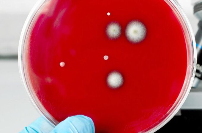La lucha contra las infecciones por superbacterias va con retraso