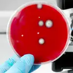  Las superbacterias: la amenaza durmiente que vive entre nosotros 