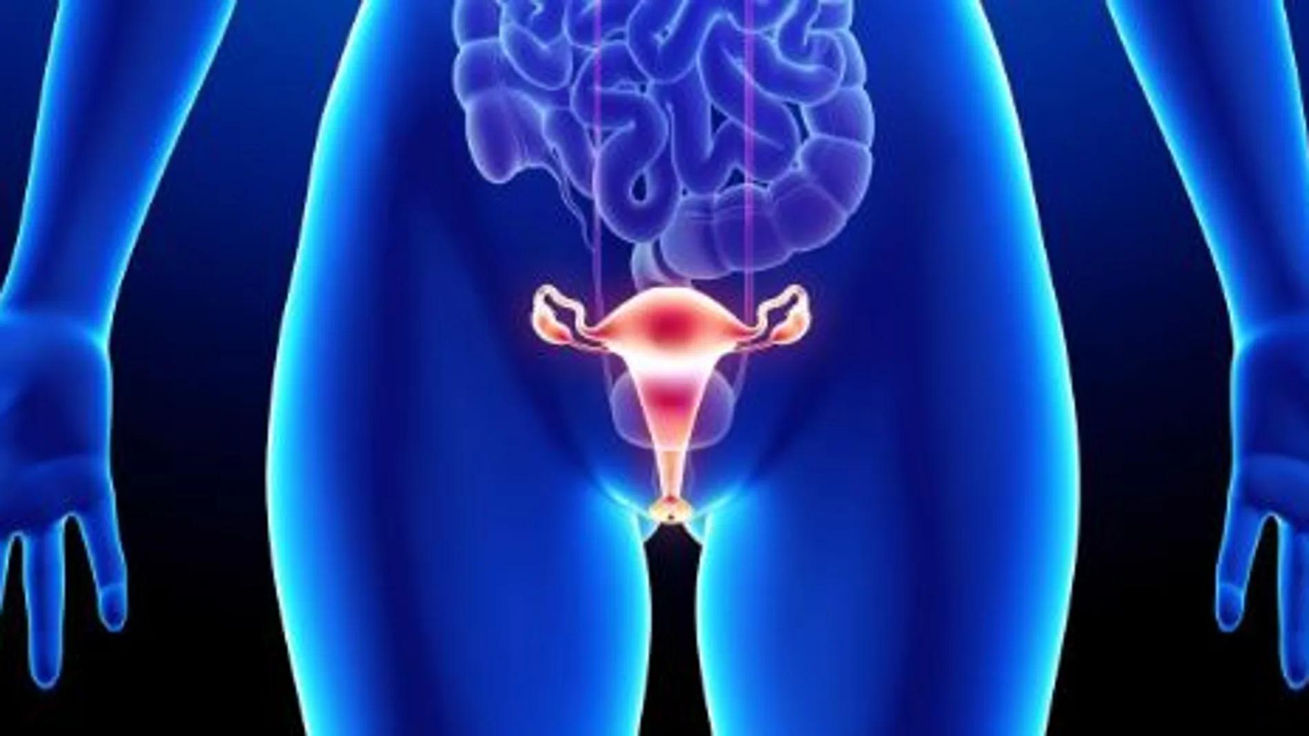 Imagen de un escáner de un caso de cáncer de ovarios