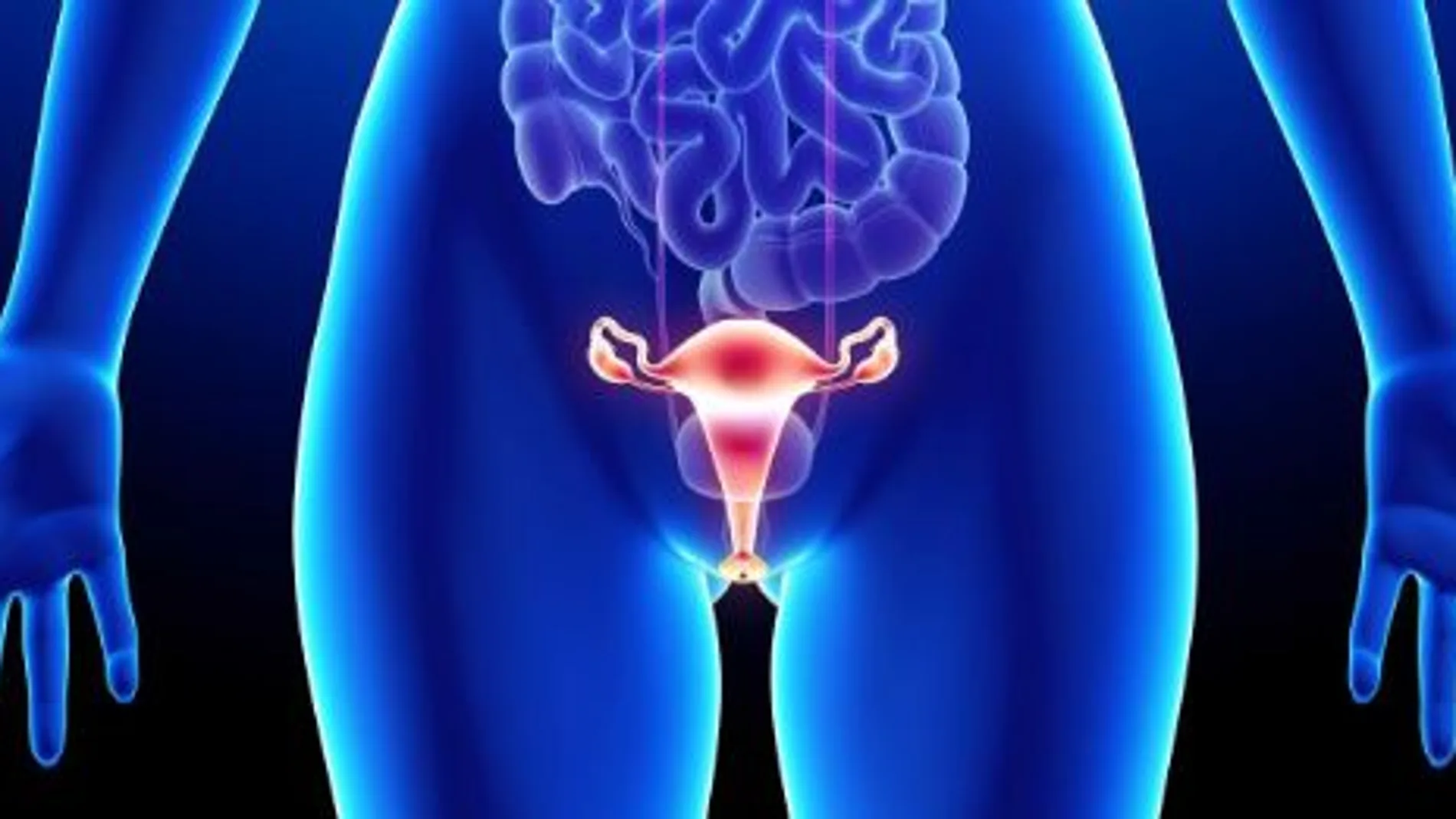 En España se dan 3.545 diagnósticos de cáncer de ovario anualmente | Imagen cedida