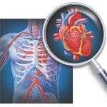 Las pacientes con problemas cardiacos son personas de riesgo ante el Covid-19