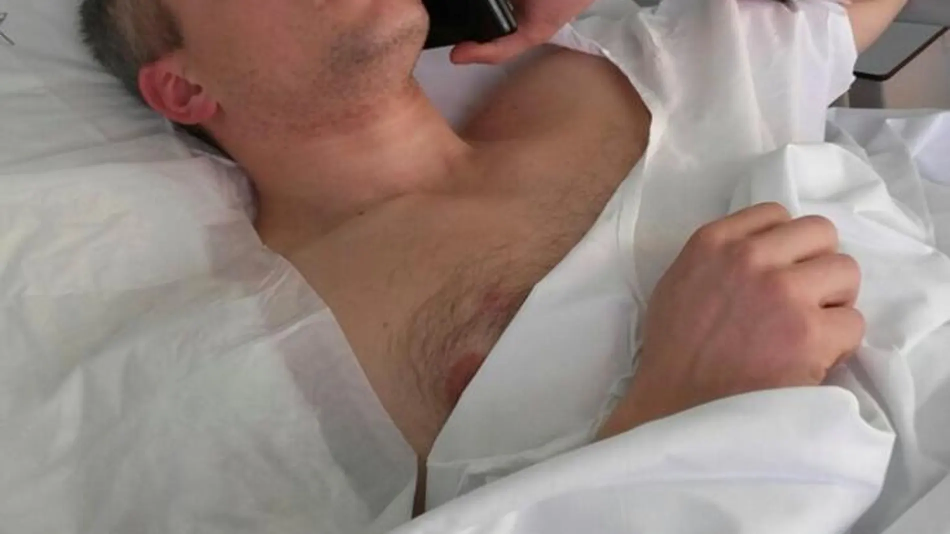Christian Movio, de 36 años, se recupera de la intervención quirúrgica en el hospital de San Gerardo de Monza. Le extrajeron una bala del hombro