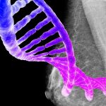 Cáncer de mama: Innovadoras terapias y nuevos usos de fármacos ya aprobados se alían contra el tumor
