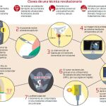 Terapia focal de vanguardia contra el cáncer de próstata