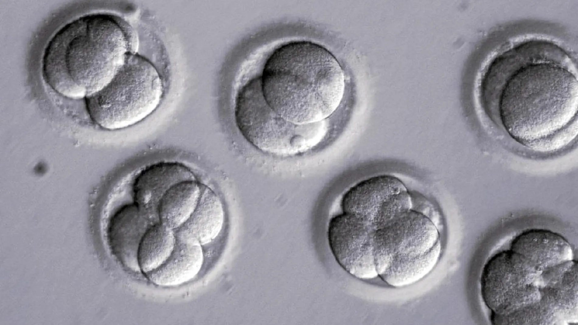 Un grupo de científicos ha conseguido borrar una enfermedad genética en embriones humanos