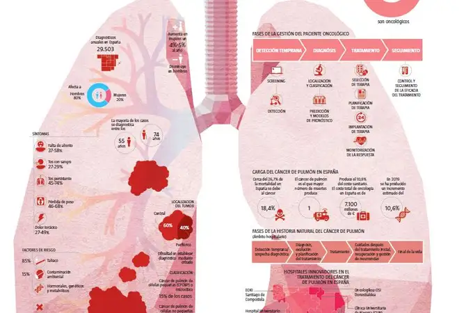 Mejorar la gestión en el cáncer de pulmón eleva su supervivencia
