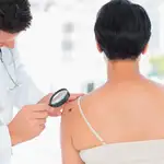 Más de 6.000 casos de melanoma al año en España