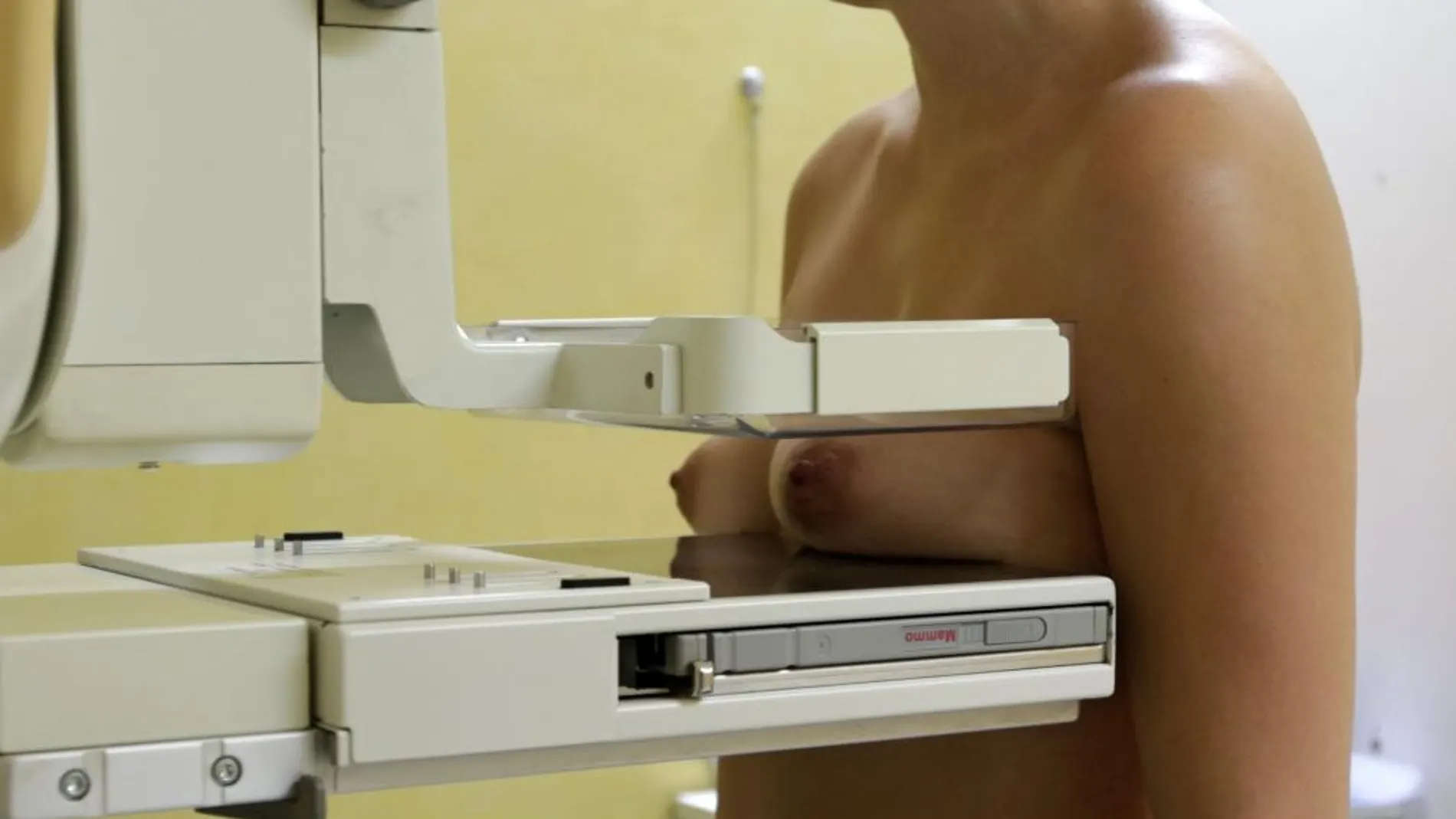 El riesgo de sufrir otro tumor aumenta un 39% tras un cáncer de mama