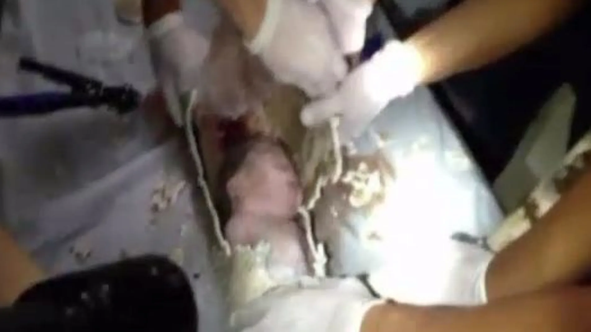 El bebé durante el rescate