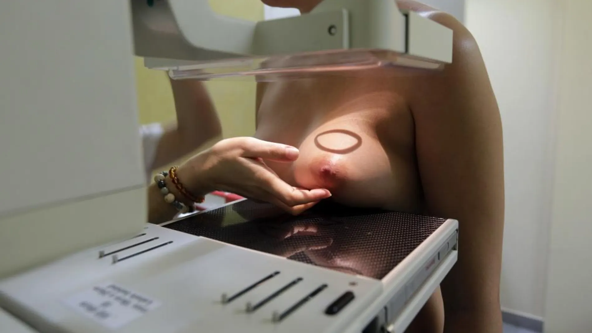 Una paciente se somete a una mamografía para prevenir el cáncer de mama