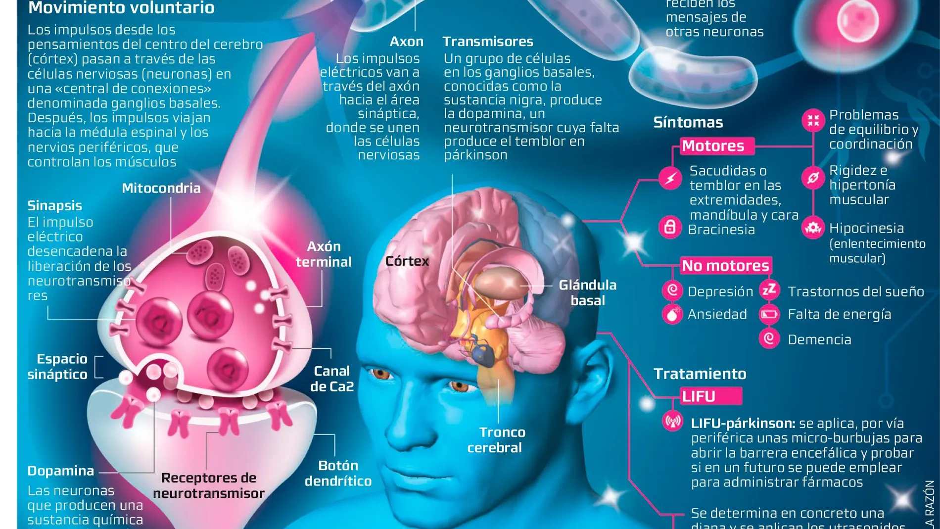 Cuando se padece párkinson la dopamina no funciona correctamente | Antonio Cruz, La Razón