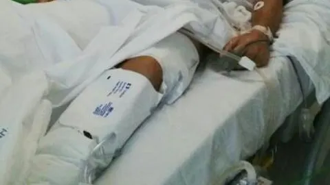 Manuel Escribano, en la UCI del hospital