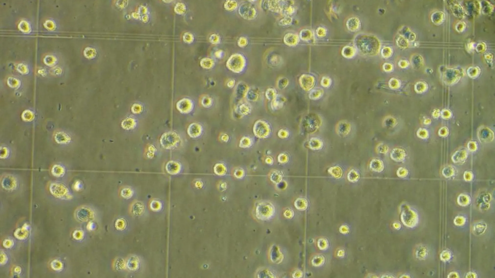 Imagen de archivo de células madre en estudio para tratar con éxito las fístulas de la enfermedad de Crohn, una grave patología del intestino. En la foto, aspecto de las células madre.