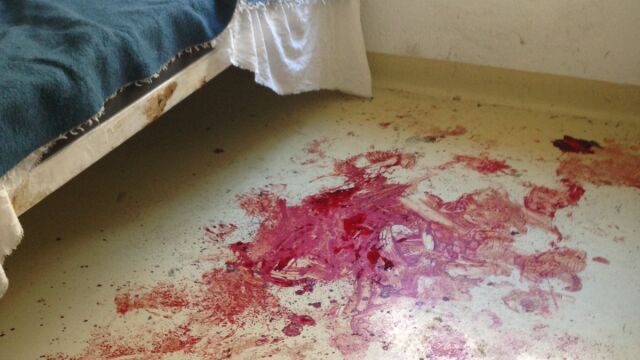 Manchas de sangre derivadas del corte en el brazo que se hizo a sí mismo el recluso