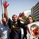 Simpatizantes del presidente depuesto Mohamed Mursi protestancon las manos manchadas de sangre