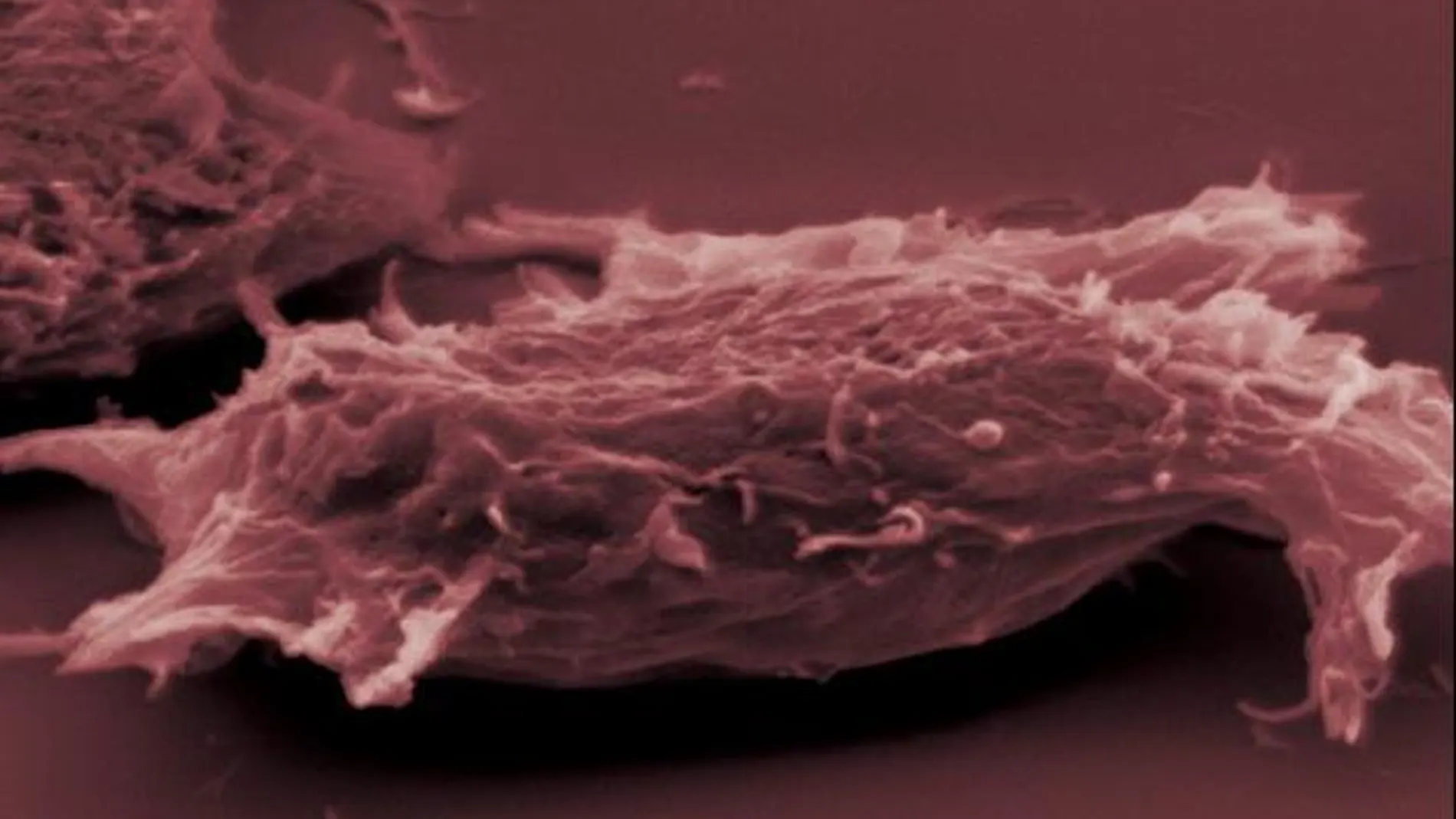 Células cancerígenas