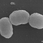Burkholderia cenocepacia