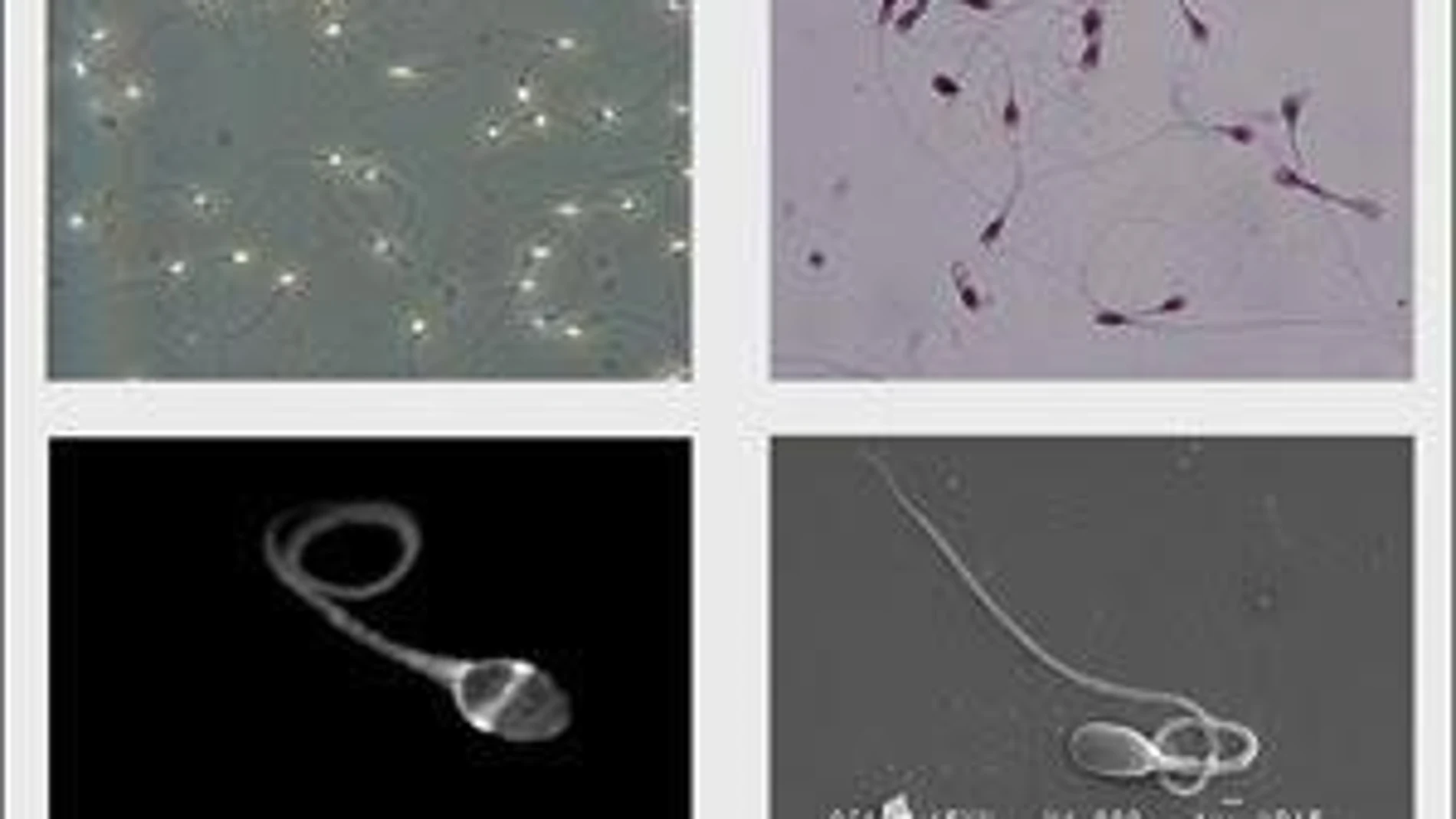 Un «asistente virtual» averigua la densidad de espermatozoides