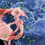 Viriones de VIH-1 (en verde) ensamblándose en la superficie de un linfocito