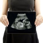 El negocio del aborto: 40 millones menos para las clínicas