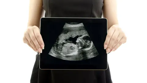 El negocio del aborto: 40 millones menos para las clínicas