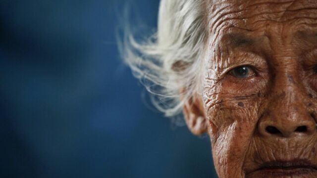 Las arrugas son la huella más evidente del envejecimiento en los humanos