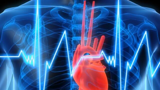 Alertan sobre rotura en enchufes de un sistema portátil de medición de arteria pulmonar