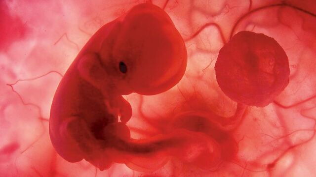 Una imagen de un embrión humano