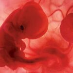 Una imagen de un embrión humano
