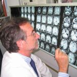 Hasta ahora el combate contra la epilpesia se había centrado en el cerebro