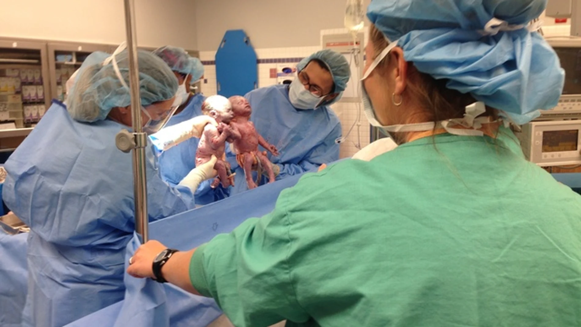 El equipo médico no pudo evitar hacer fotografías del momento.