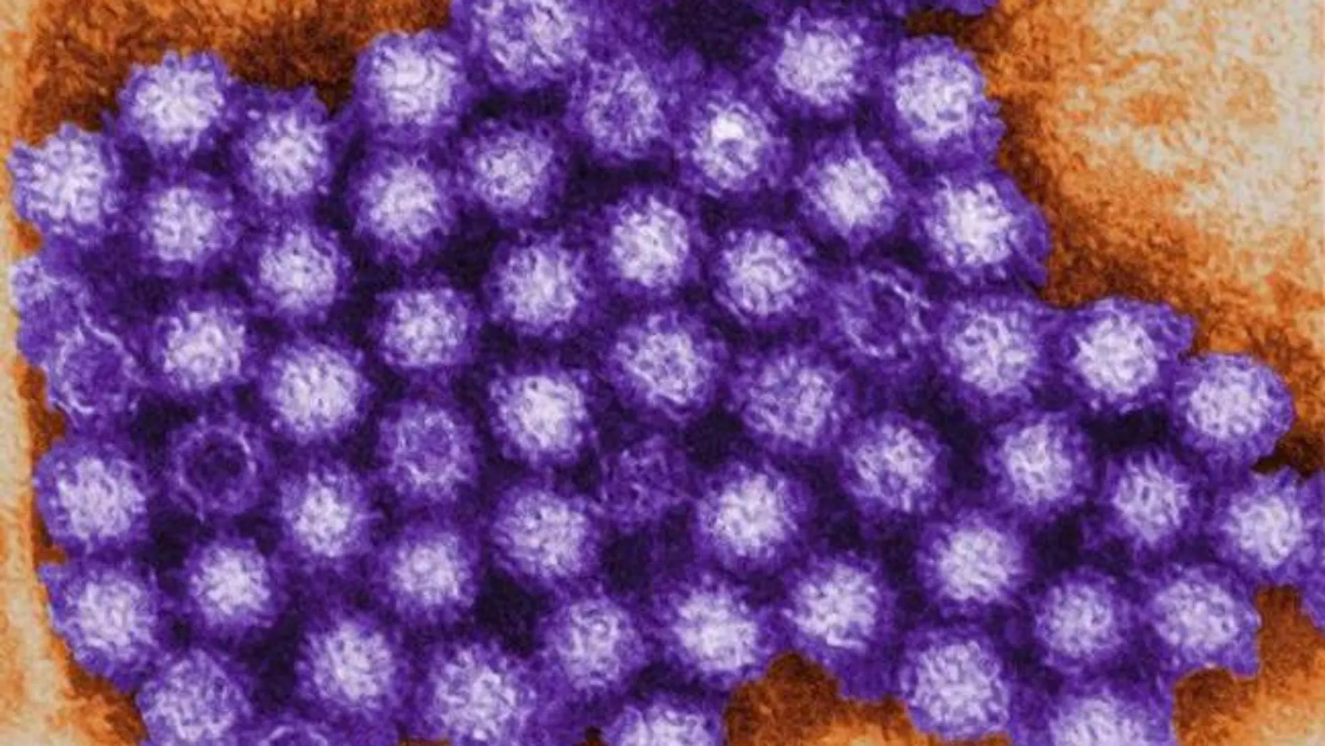 Imagen miocroscópica del norovirus