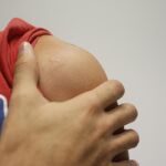 Un paciente con dolor en el hombro