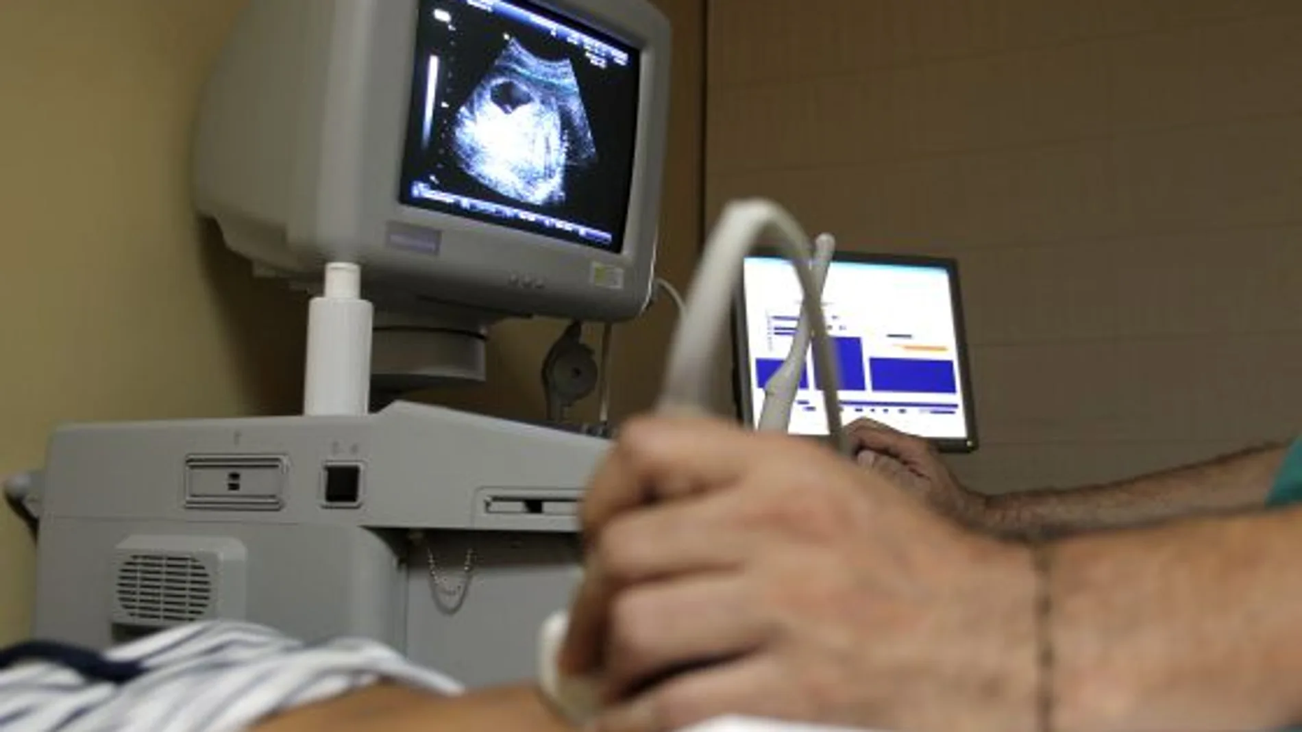 El aborto generó más de 40 millones de euros para las clínicas