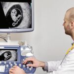 Antes de la sexta semana de gestación se pueden identificar los latidos del corazón del feto