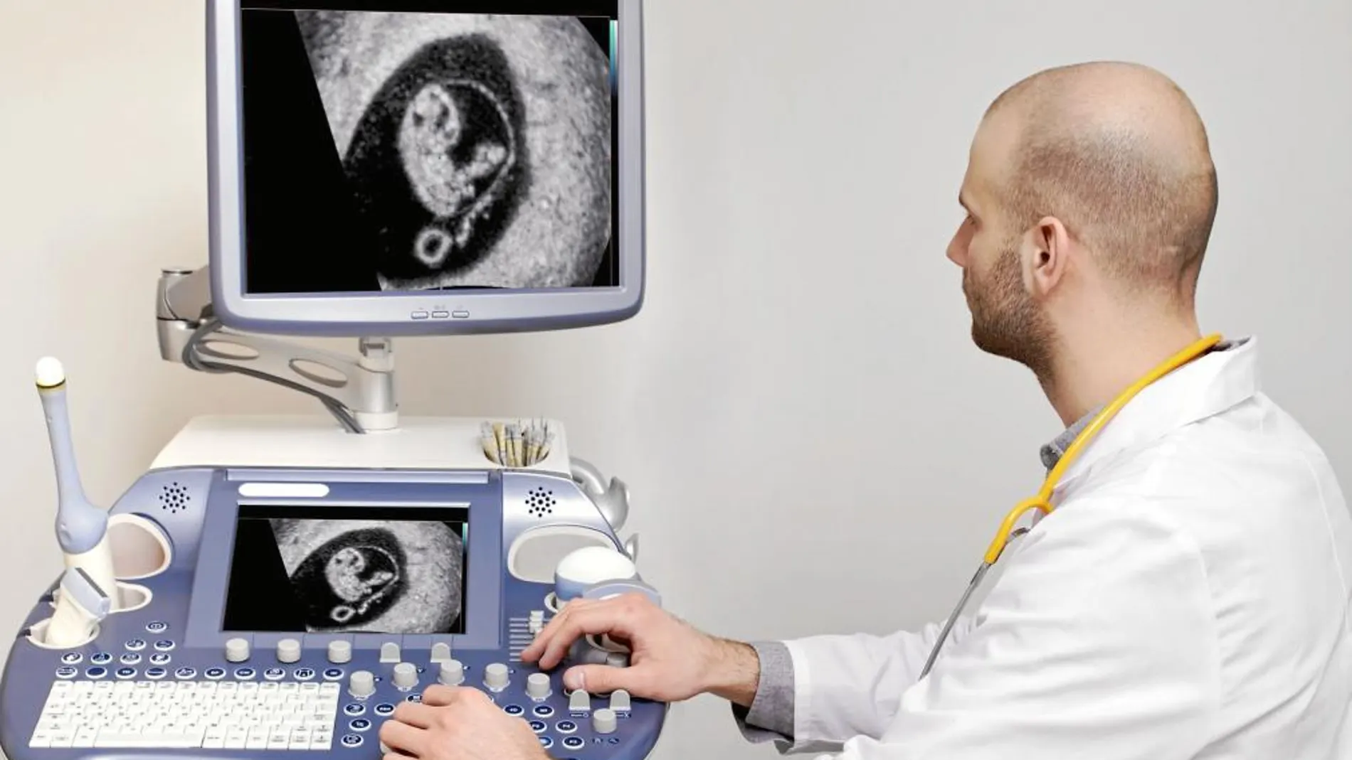 Antes de la sexta semana de gestación se pueden identificar los latidos del corazón del feto