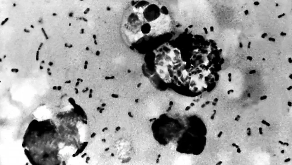 La bacteria que causa la peste bubónica