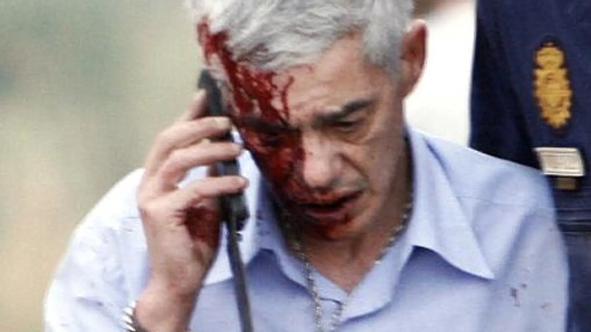 En la imagen, el maqunista, Francisco José Garzón, herido tras el accidente, habla por el móvil