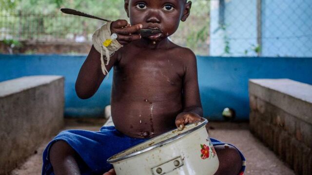 El 41% de los menores de cinco años sufren malnutrición crónica