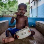 El 41% de los menores de cinco años sufren malnutrición crónica